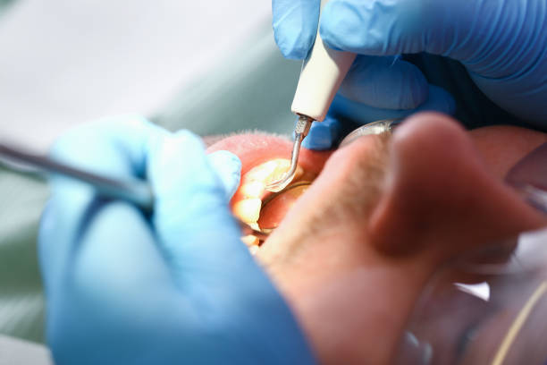 Best Emergency Dentist for Knocked-Out Tooth in Imperial, CA