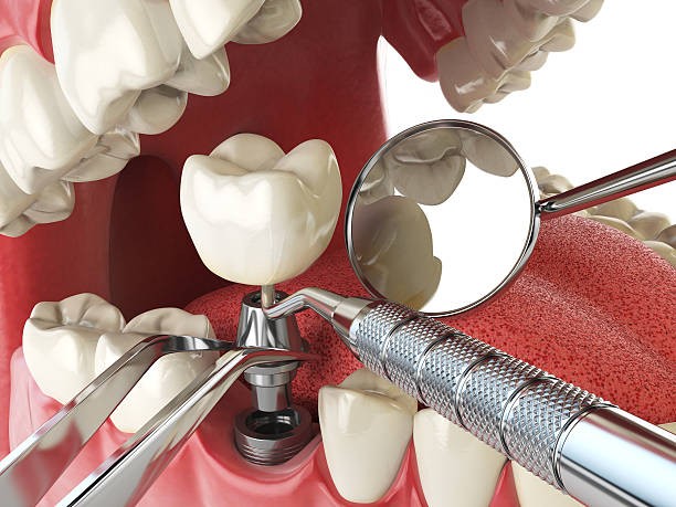 Best Mobile Emergency Dentist in Imperial, CA